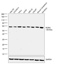 Invitrogen RORA Polyclonal Antibody 100 &mu;g; Unconjugated:Antibodies,