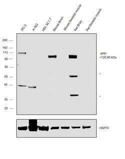 Invitrogen Amyloid Precursor Protein Polyclonal Antibody 100 &mu;g; Unconjugated:Antibodies,