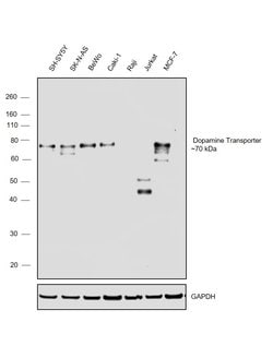 Invitrogen™ Dopamine Transporter Polyclonal Antibody