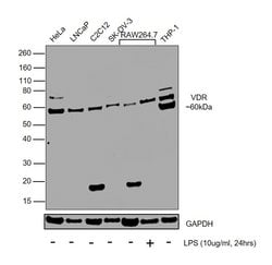 VDR Polyclonal Antibody, Invitrogen 100 &mu;g | Buy Online | Thermo Scientific | Fisher Scientific