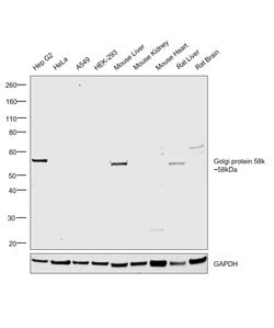 Invitrogen Golgi protein 58k Polyclonal Antibody 100 &mu;g; Unconjugated:Antibodies,
