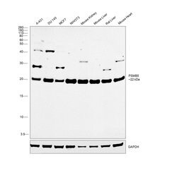 Invitrogen PSMB5 Polyclonal Antibody 100 &mu;g; Unconjugated:Antibodies,