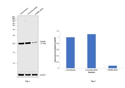 Invitrogen PSMB6 Polyclonal Antibody 100 &mu;g | Buy Online | Invitrogen&trade; | Fisher Scientific