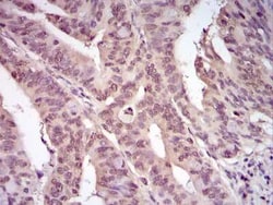 Invitrogen Ubiquitin Polyclonal Antibody 50 &mu;L; Unconjugated:Anticuerpos