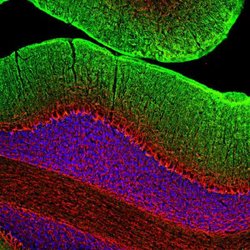 Invitrogen NEFM Polyclonal Antibody 100 &mu;L; Unconjugated:Antibodies,