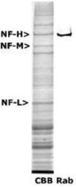 Invitrogen NF-H Polyclonal Antibody 50 &mu;L; Unconjugated:Anticorps, Polyclonal