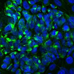 Invitrogen Peripherin Polyclonal Antibody 100 &mu;L; Unconjugated:Antibodies,