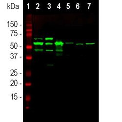 Invitrogen Peripherin Polyclonal Antibody 100 &mu;L; Unconjugated:Antibodies,