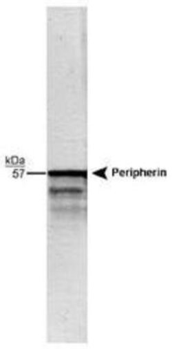 Invitrogen Peripherin Polyclonal Antibody 100 &mu;L; Unconjugated:Antibodies,