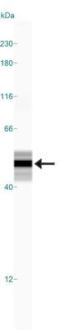 Invitrogen GFAP Polyclonal Antibody 50 &mu;L | Buy Online | Invitrogen&trade; | Fisher Scientific