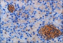 Invitrogen SSTR2 Polyclonal Antibody 100 &mu;L; Unconjugated:Antibodies,