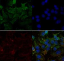Invitrogen SR-BI Polyclonal Antibody 100 &mu;L | Buy Online | Invitrogen&trade; | Fisher Scientific