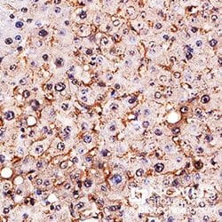 Invitrogen SR-BI Polyclonal Antibody 100 &mu;L | Buy Online | Invitrogen&trade; | Fisher Scientific