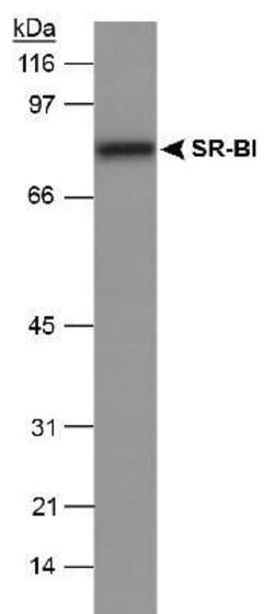 Invitrogen SR-BI Polyclonal Antibody 100 &mu;L | Buy Online | Invitrogen&trade; | Fisher Scientific