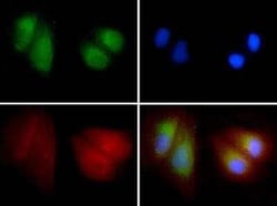 Invitrogen LIMP2 Polyclonal Antibody 100 &mu;L; Unconjugated:Anticorps,