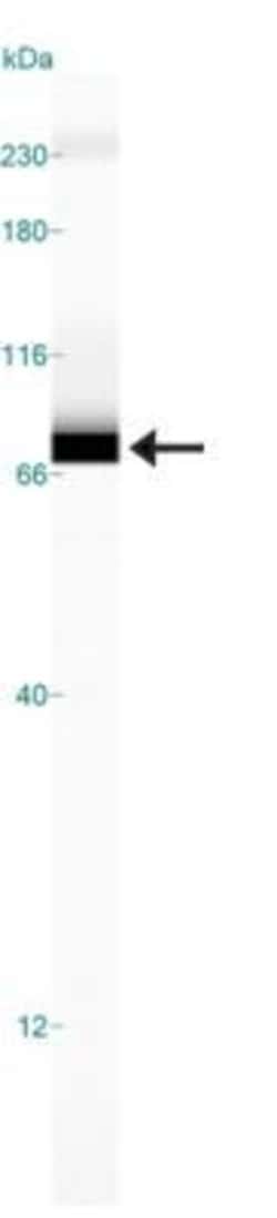 Invitrogen ABCF2 Polyclonal Antibody 100 &mu;L; Unconjugated:Antibodies,