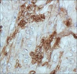 Cathepsin E Polyclonal Antibody, Invitrogen 100 &mu;L; Unconjugated:Antibodies,