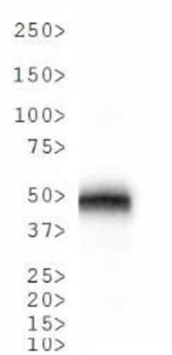 Cathepsin E Polyclonal Antibody, Invitrogen 100 &mu;L; Unconjugated:Antibodies,