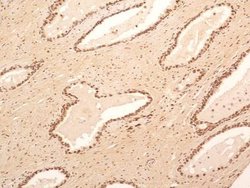 Invitrogen NuMA Polyclonal Antibody 100 &mu;L | Buy Online | Invitrogen&trade; | Fisher Scientific