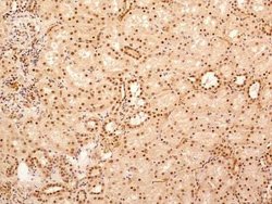 Invitrogen NuMA Polyclonal Antibody 100 &mu;L | Buy Online | Invitrogen&trade; | Fisher Scientific