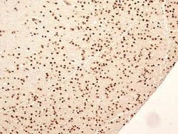 Invitrogen NuMA Polyclonal Antibody 100 &mu;L | Buy Online | Invitrogen&trade; | Fisher Scientific