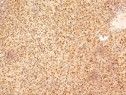 Invitrogen NuMA Polyclonal Antibody 100 &mu;L | Buy Online | Invitrogen&trade; | Fisher Scientific