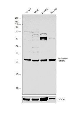 Invitrogen Endothelin 1 Polyclonal Antibody 100 &mu;L; Unconjugated:Antibodies,