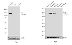 Invitrogen NEFM Polyclonal Antibody 100 &mu;L; Unconjugated:Antibodies,