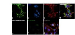 Invitrogen NEFM Polyclonal Antibody 100 &mu;L; Unconjugated:Antibodies,