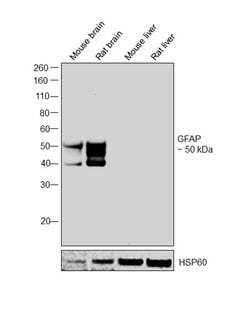 Invitrogen GFAP Polyclonal Antibody 50 &mu;L | Buy Online | Invitrogen&trade; | Fisher Scientific