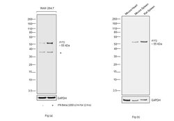 IFIT2 Polyclonal Antibody, Invitrogen 100 &mu;L; Unconjugated:Antibodies,