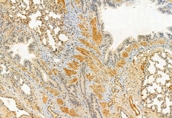Invitrogen Kindlin 2 Polyclonal Antibody 100 &mu;L; Unconjugated:Antibodies,