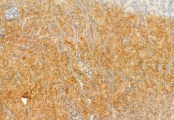 Invitrogen Kindlin 2 Polyclonal Antibody 100 &mu;L; Unconjugated:Antibodies,