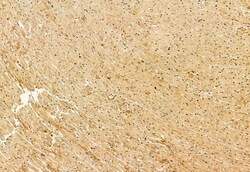 Invitrogen OXCT1 Polyclonal Antibody 100 &mu;L; Unconjugated:Antibodies,