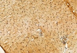 Invitrogen OXCT1 Polyclonal Antibody 100 &mu;L; Unconjugated:Antibodies,