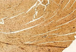 Invitrogen OXCT1 Polyclonal Antibody 100 &mu;L; Unconjugated:Antibodies,