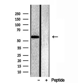 Invitrogen OXCT1 Polyclonal Antibody 100 &mu;L; Unconjugated:Antibodies,