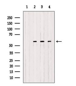 Invitrogen OXCT1 Polyclonal Antibody 100 &mu;L; Unconjugated:Antibodies,
