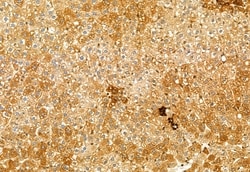 Invitrogen RNaseH1 Polyclonal Antibody 100 &mu;L; Unconjugated:Antibodies,
