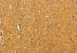 Invitrogen RNaseH1 Polyclonal Antibody 100 &mu;L; Unconjugated:Antibodies,