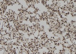 Invitrogen RNaseH1 Polyclonal Antibody 100 &mu;L; Unconjugated:Antibodies,