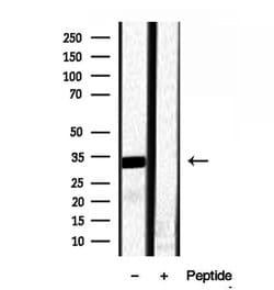 Invitrogen RNaseH1 Polyclonal Antibody 100 &mu;L; Unconjugated:Antibodies,