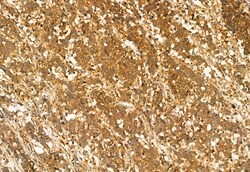 Invitrogen AdoHcyase 2 Polyclonal Antibody 100 &mu;L; Unconjugated:Antibodies,
