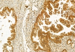 Invitrogen AdoHcyase 2 Polyclonal Antibody 100 &mu;L; Unconjugated:Antibodies,