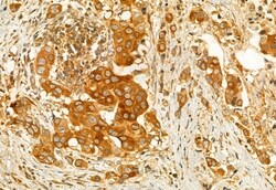 Invitrogen AdoHcyase 2 Polyclonal Antibody 100 &mu;L; Unconjugated:Antibodies,