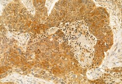 Invitrogen AdoHcyase 2 Polyclonal Antibody 100 &mu;L; Unconjugated:Antibodies,