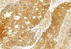 Invitrogen AdoHcyase 2 Polyclonal Antibody 100 &mu;L; Unconjugated:Antibodies,