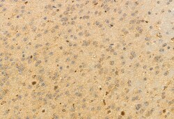Invitrogen HMGCS1 Polyclonal Antibody 100 &mu;L; Unconjugated:Antibodies,