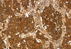 Invitrogen HMGCS1 Polyclonal Antibody 100 &mu;L; Unconjugated:Antibodies,