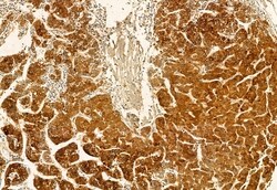 Invitrogen HMGCS1 Polyclonal Antibody 100 &mu;L; Unconjugated:Antibodies,